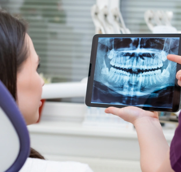 Dental X-Rays